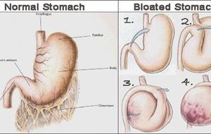 Torsion d'estomac